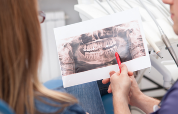 Dental X-Ray