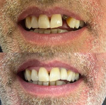 Patient result 1