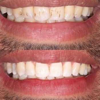 Patient result 3