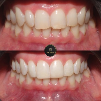 Patient result 2